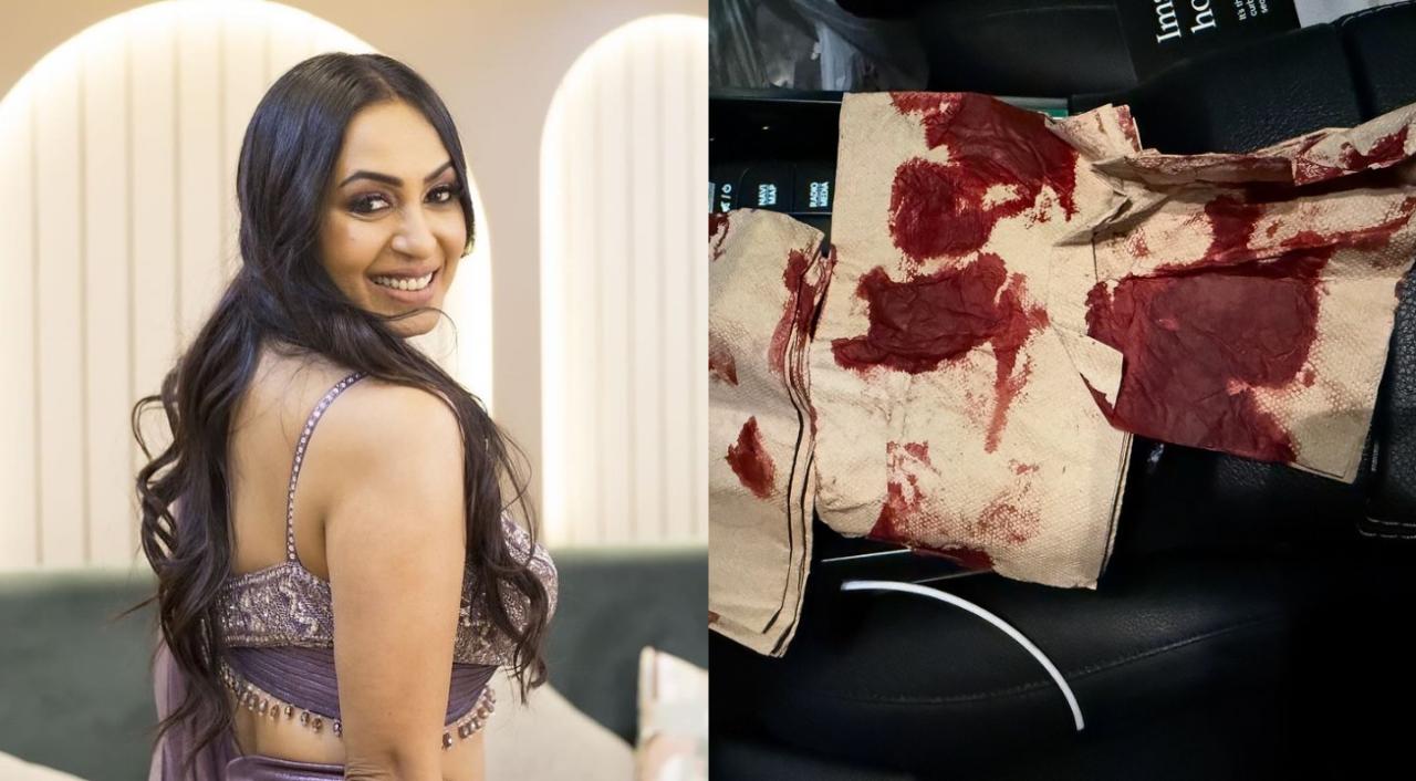 Kashmera Shah meets with accident, shares picture of blood-soaked tissues